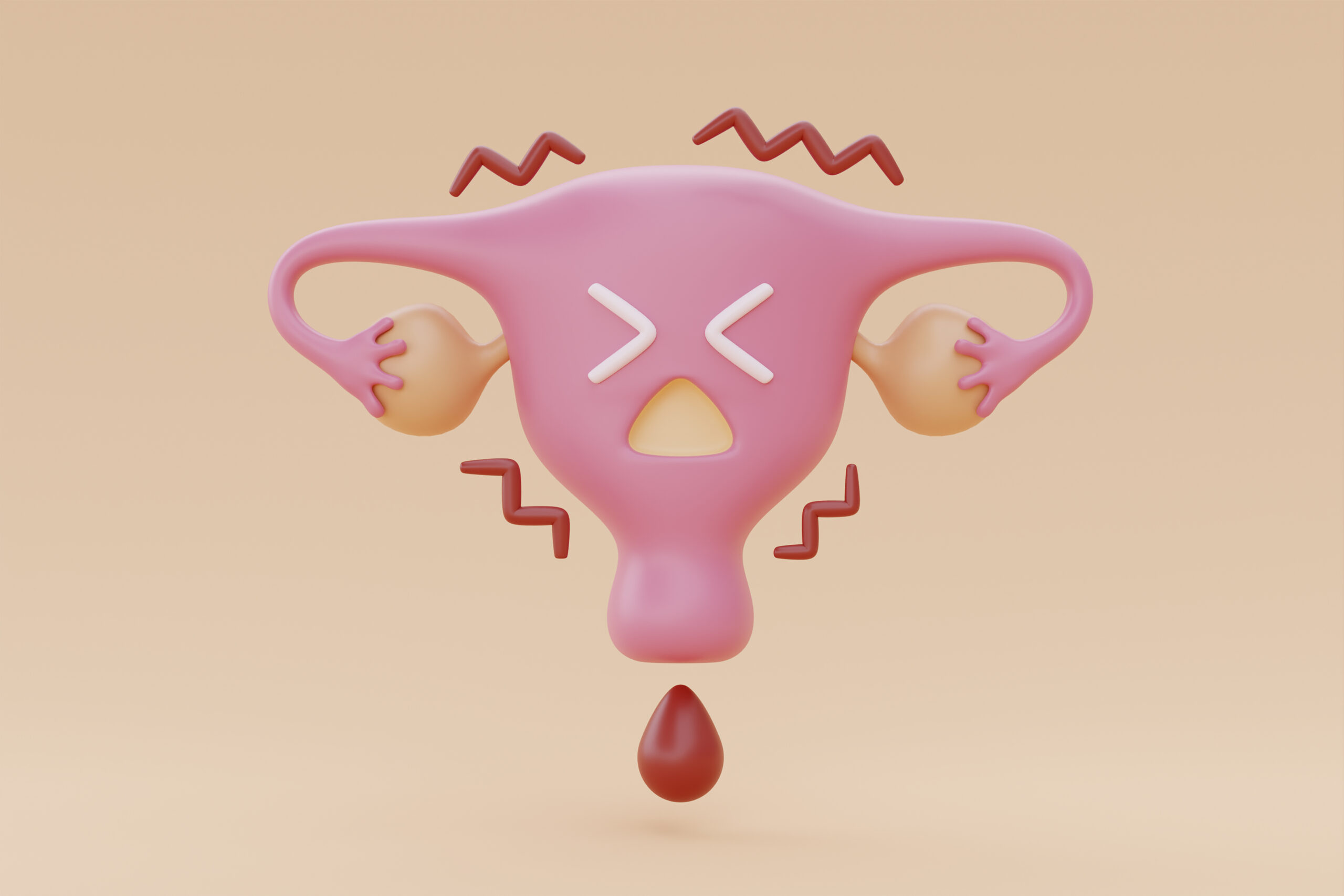PCOS uterus